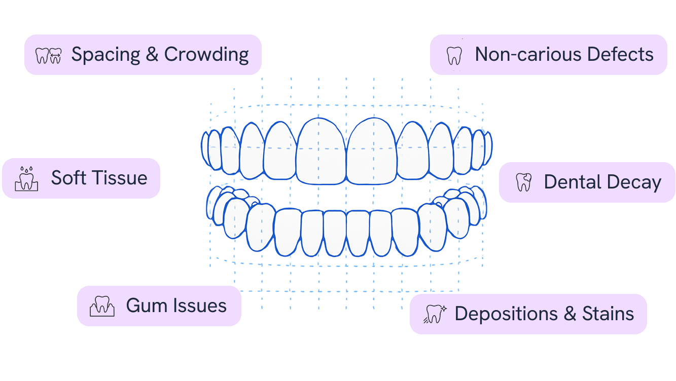 Detailed Teeth Scan